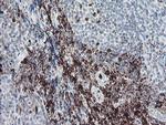 F13A1 Antibody in Immunohistochemistry (Paraffin) (IHC (P))