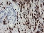 F13A1 Antibody in Immunohistochemistry (Paraffin) (IHC (P))