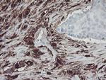 F13A1 Antibody in Immunohistochemistry (Paraffin) (IHC (P))