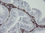 F13A1 Antibody in Immunohistochemistry (Paraffin) (IHC (P))