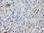 F13A1 Antibody in Immunohistochemistry (Paraffin) (IHC (P))