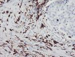 F13A1 Antibody in Immunohistochemistry (Paraffin) (IHC (P))