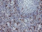 F13A1 Antibody in Immunohistochemistry (Paraffin) (IHC (P))