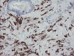 F13A1 Antibody in Immunohistochemistry (Paraffin) (IHC (P))