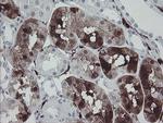 F13A1 Antibody in Immunohistochemistry (Paraffin) (IHC (P))