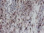 F13A1 Antibody in Immunohistochemistry (Paraffin) (IHC (P))