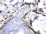 F13A1 Antibody in Immunohistochemistry (Paraffin) (IHC (P))