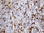 F13A1 Antibody in Immunohistochemistry (Paraffin) (IHC (P))