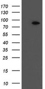 F13A1 Antibody in Western Blot (WB)