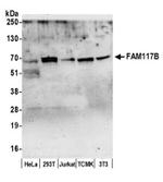 FAM117B/ALS2CR13 Antibody in Western Blot (WB)