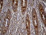 FAM54A Antibody in Immunohistochemistry (Paraffin) (IHC (P))