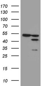 FAM54A Antibody in Western Blot (WB)