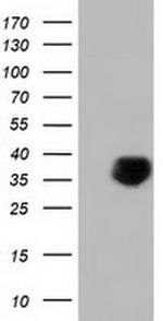 FAM84B Antibody in Western Blot (WB)