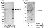 FANCD2 Antibody in Western Blot (WB)