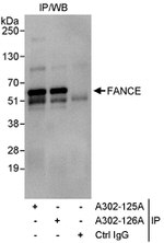 FANCE Antibody in Immunoprecipitation (IP)