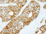 FASN Antibody in Immunohistochemistry (IHC)