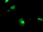 FBXO21 Antibody in Immunocytochemistry (ICC/IF)