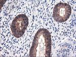 FBXO21 Antibody in Immunohistochemistry (Paraffin) (IHC (P))