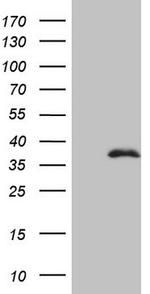 FBXO8 Antibody in Western Blot (WB)
