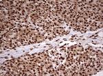 FBXW7 Antibody in Immunohistochemistry (Paraffin) (IHC (P))