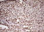 FBXW7 Antibody in Immunohistochemistry (Paraffin) (IHC (P))