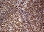 FBXW7 Antibody in Immunohistochemistry (Paraffin) (IHC (P))