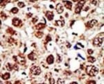 FDFT1 Antibody in Immunohistochemistry (IHC)