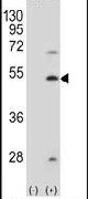 FDFT1 Antibody in Western Blot (WB)