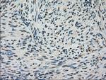 FERMT2 Antibody in Immunohistochemistry (Paraffin) (IHC (P))