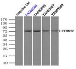 FERMT2 Antibody in Immunoprecipitation (IP)