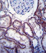 FER Antibody in Immunohistochemistry (IHC)