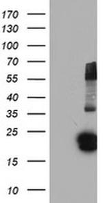 FGF21 Antibody in Western Blot (WB)