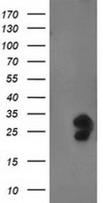 FGF21 Antibody in Western Blot (WB)