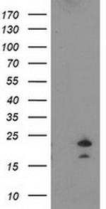 FGF21 Antibody in Western Blot (WB)