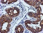 FGFR2 Antibody in Immunohistochemistry (Paraffin) (IHC (P))