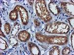 FGFR2 Antibody in Immunohistochemistry (Paraffin) (IHC (P))