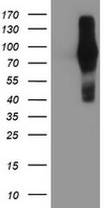 FGFR2 Antibody in Western Blot (WB)