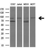 FGFR2 Antibody in Western Blot (WB)