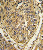 FGFR2 Antibody in Immunohistochemistry (IHC)