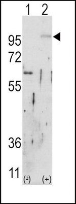 FGFR2 Antibody in Western Blot (WB)