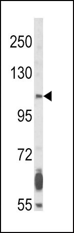 FGFR2 Antibody in Western Blot (WB)