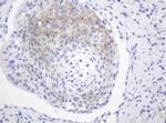 FGFR3 Antibody in Immunohistochemistry (Paraffin) (IHC (P))