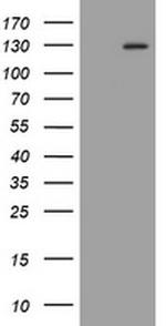 FGFR3 Antibody in Western Blot (WB)