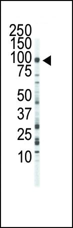 FGFR3 Antibody in Western Blot (WB)