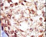 FGR Antibody in Immunohistochemistry (IHC)