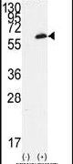 FGR Antibody in Western Blot (WB)