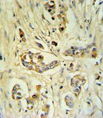 FIBB Antibody in Immunohistochemistry (IHC)