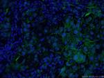 ICAM-1 Antibody in Immunohistochemistry (PFA fixed) (IHC (PFA))