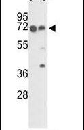 FKBP10 Antibody in Western Blot (WB)