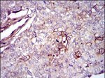 Fibronectin Antibody in Immunohistochemistry (Paraffin) (IHC (P))